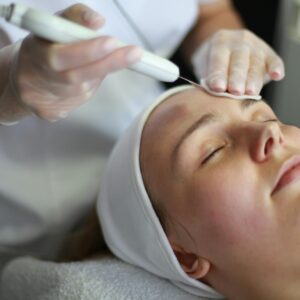 Microdermabrasion